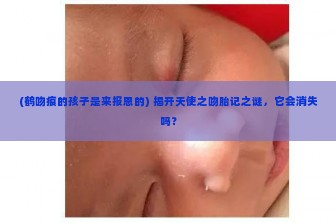 (鹤吻痕的孩子是来报恩的) 揭开天使之吻胎记之谜，它会消失吗？